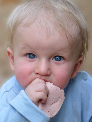 Scalp Rash in Toddlers toddler heat rash pictures. Scalp Rash in Toddlers