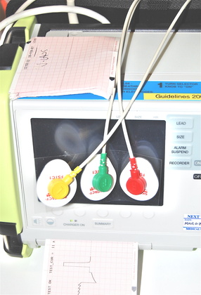 Hdl+cholesterol+levels