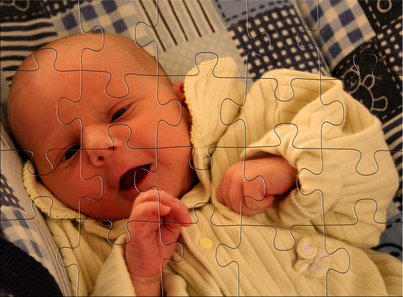 Chicken Pox Effects On An Unborn Baby | LIVESTRONG. Chicken Pox Effects On An Unborn Baby | LIVESTRONG.