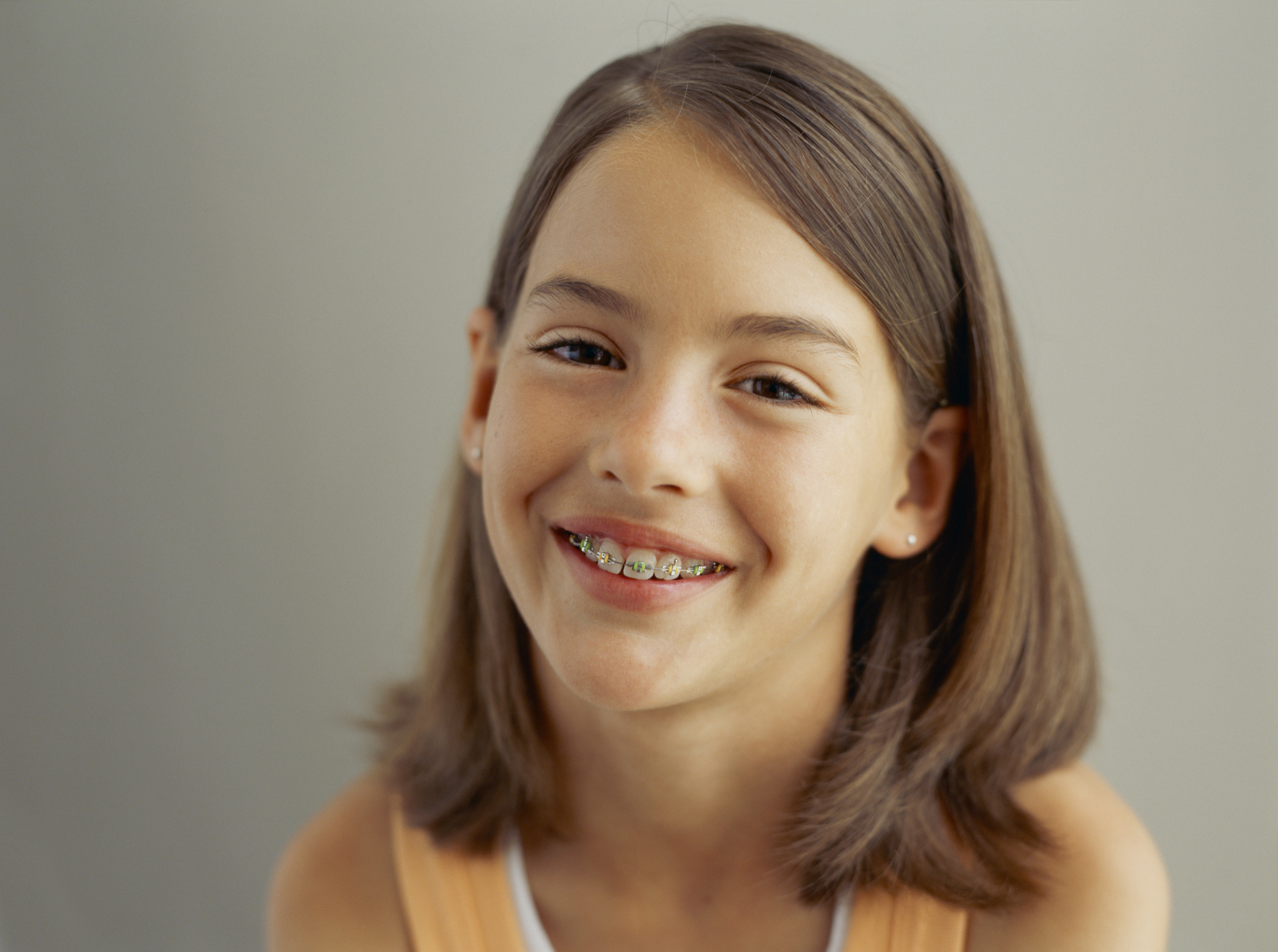 desierto Otros lugares Caballero amable cuanto cuestan los brackets de ceramica Socialismo