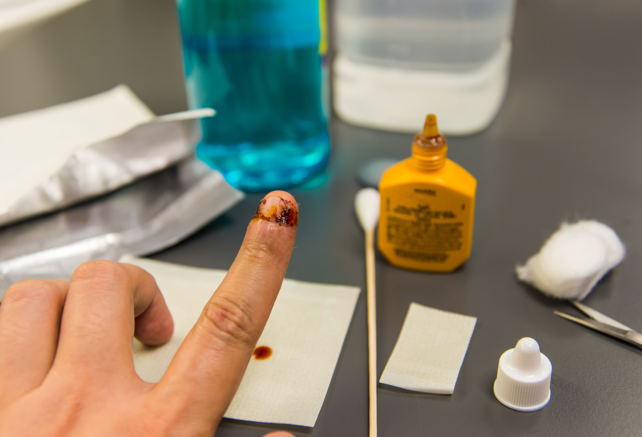 Iodine Treatment for Water Purification Healthfully