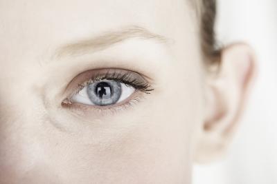 Cholesterol+deposits+under+eyes