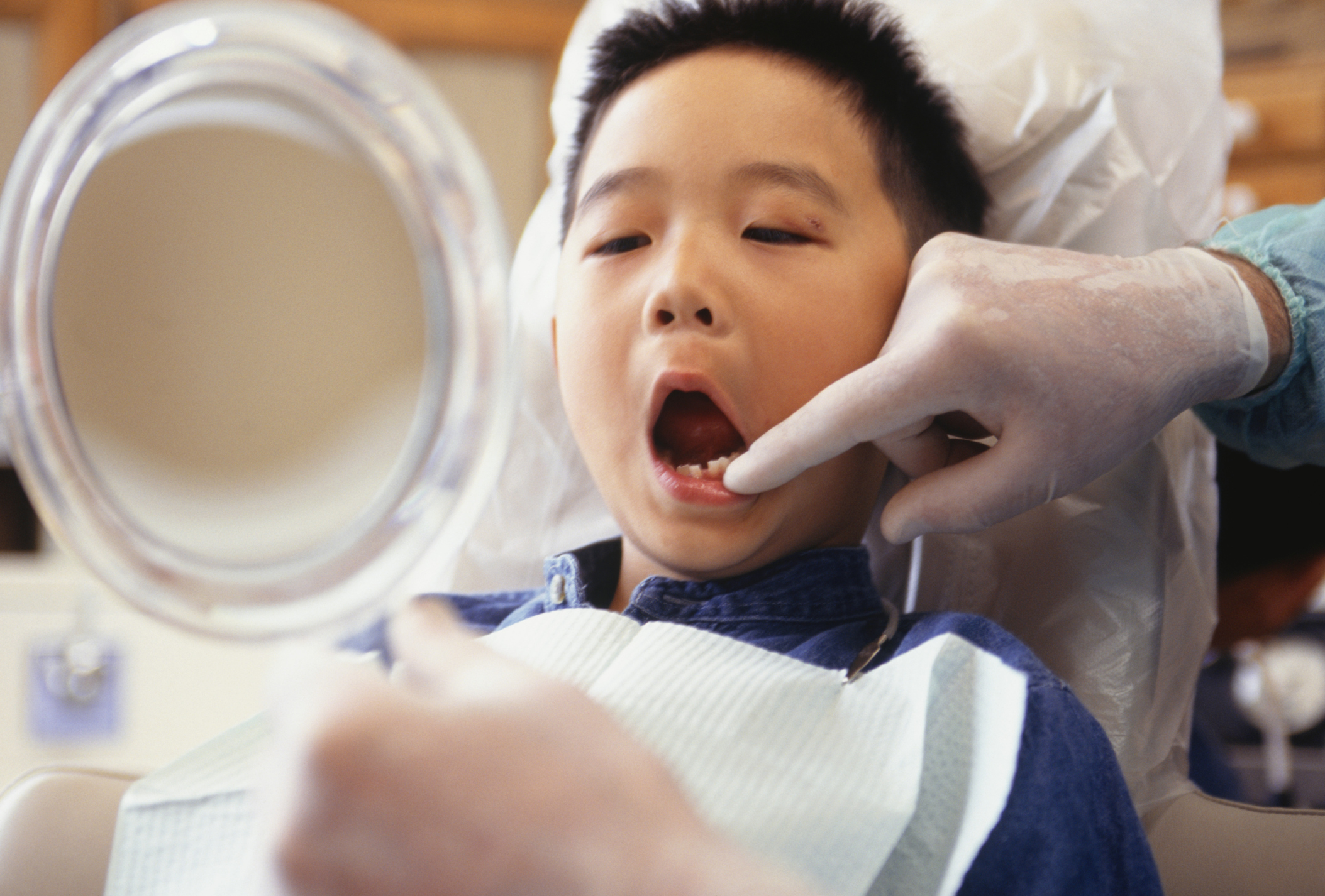 Does a Baby Tooth Need to Be Extracted When It Is Loose? Healthfully