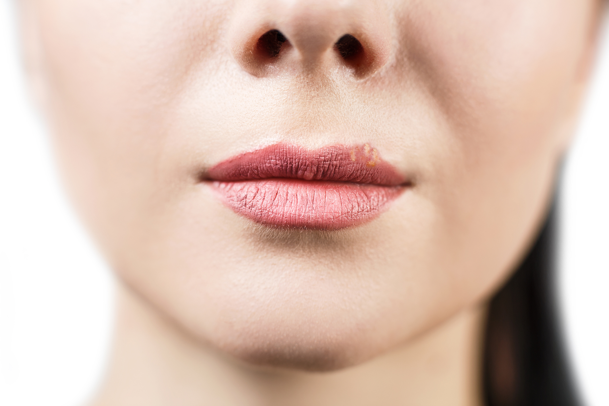 The Difference Between Ingrown Hairs Genital Herpes Healthfully