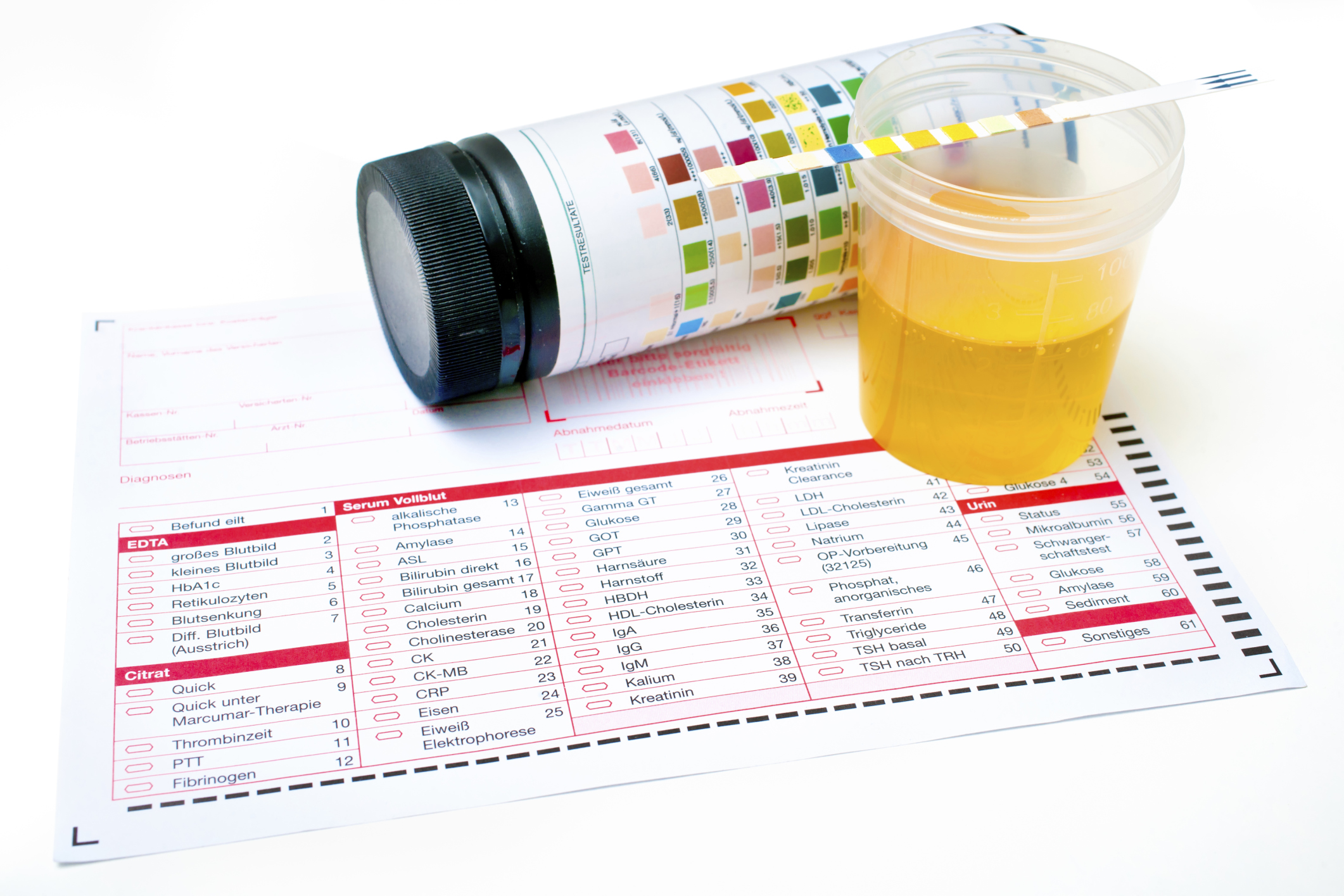 Hemoglobin in the urine: what it means Causes and signs of violation, the norm 60 Hemoglobin in the urine: what it means Causes and signs of violation, the norm 30