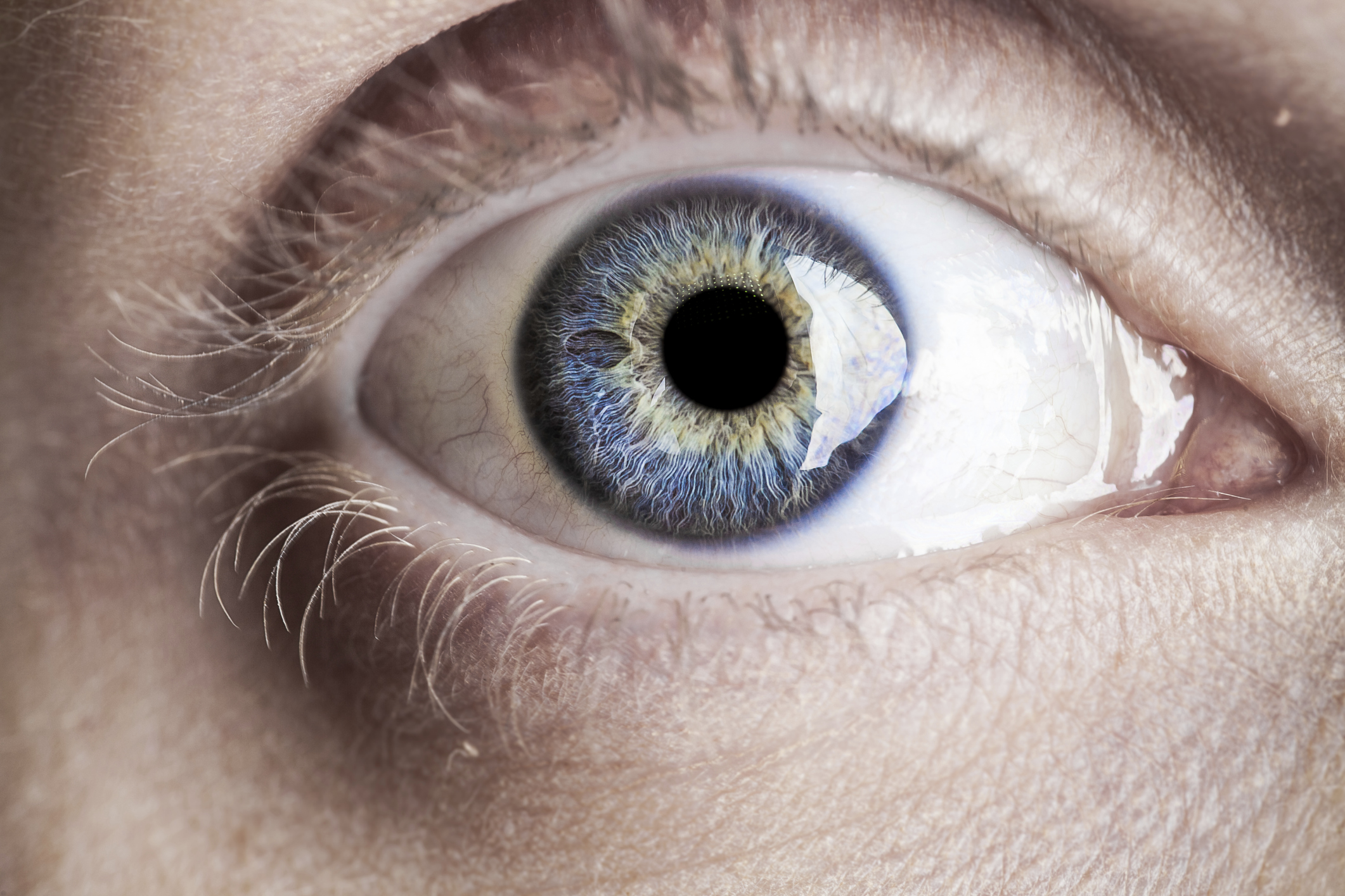 Causes of cataracts and methods of preventing disease Causes of cataracts and methods of preventing disease