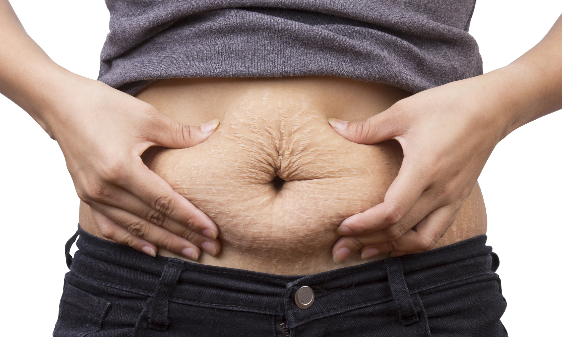 Cellulite In Children