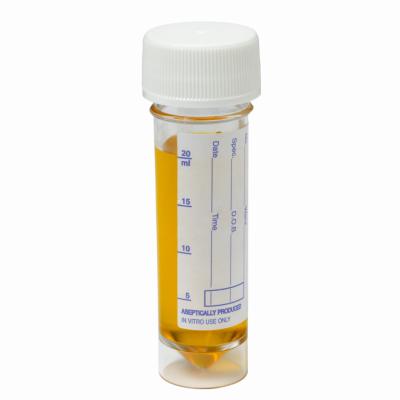Components of Urine Analysis | LIVESTRONG.COM