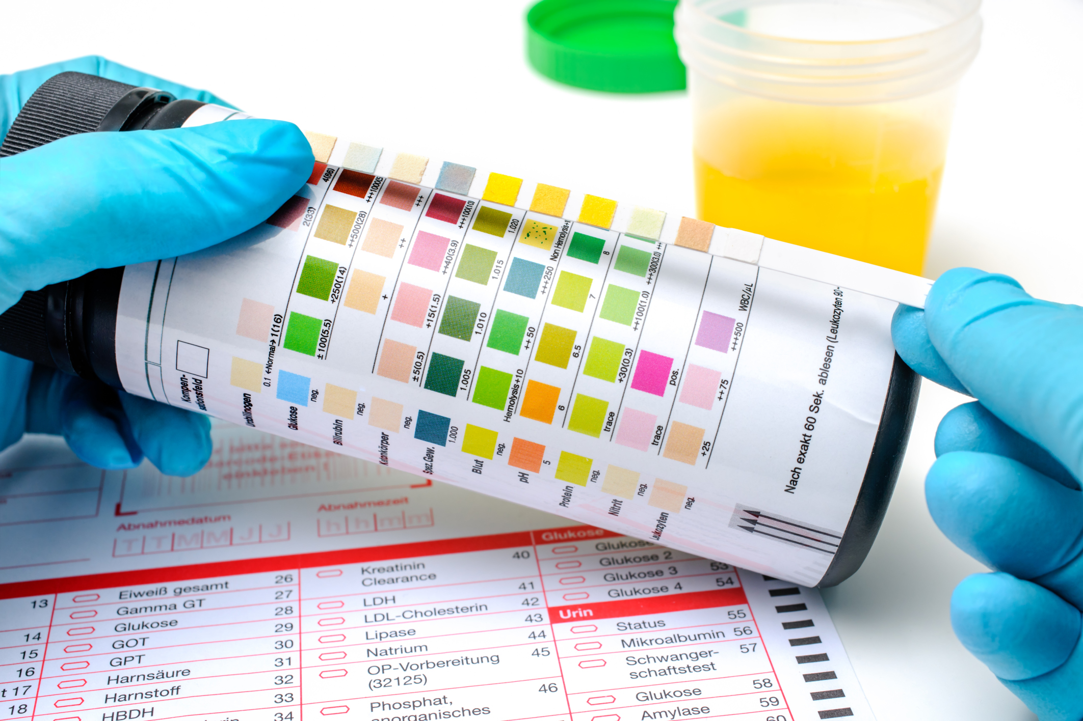 Causes of increased white blood cells in the urine in infants Causes of increased white blood cells in the urine in infants