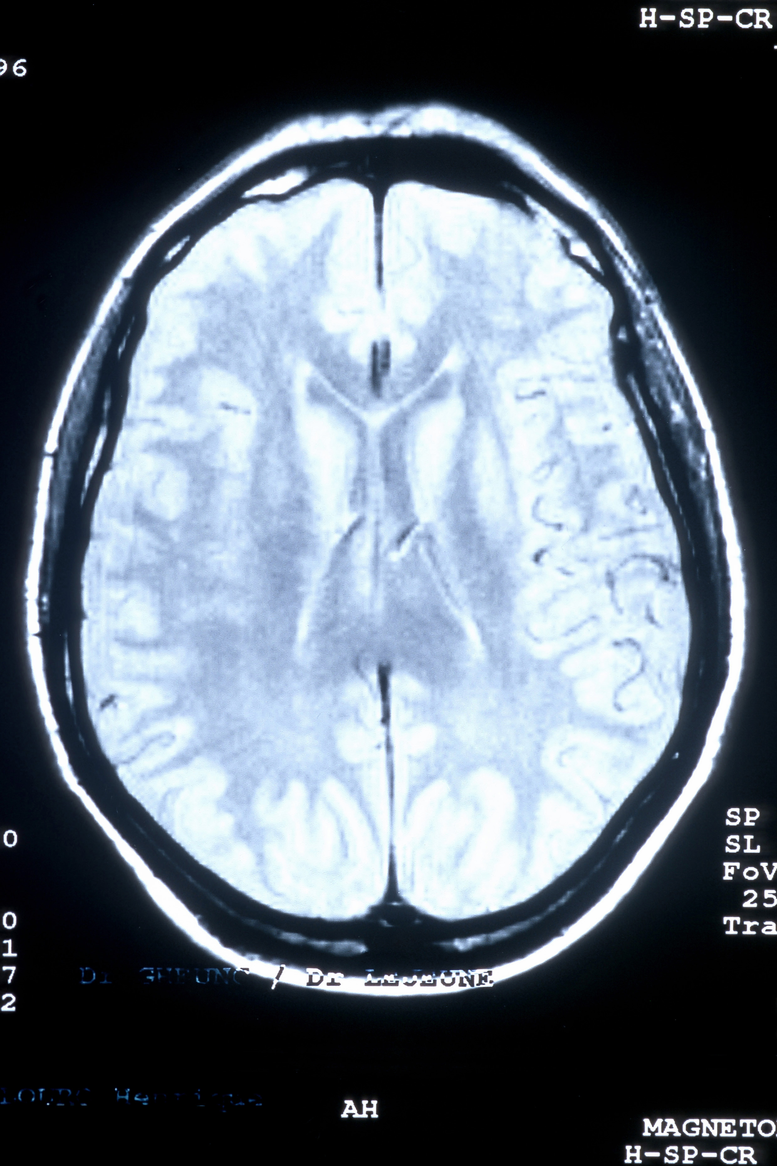 Jobs & Salary for a Neuroscience Major