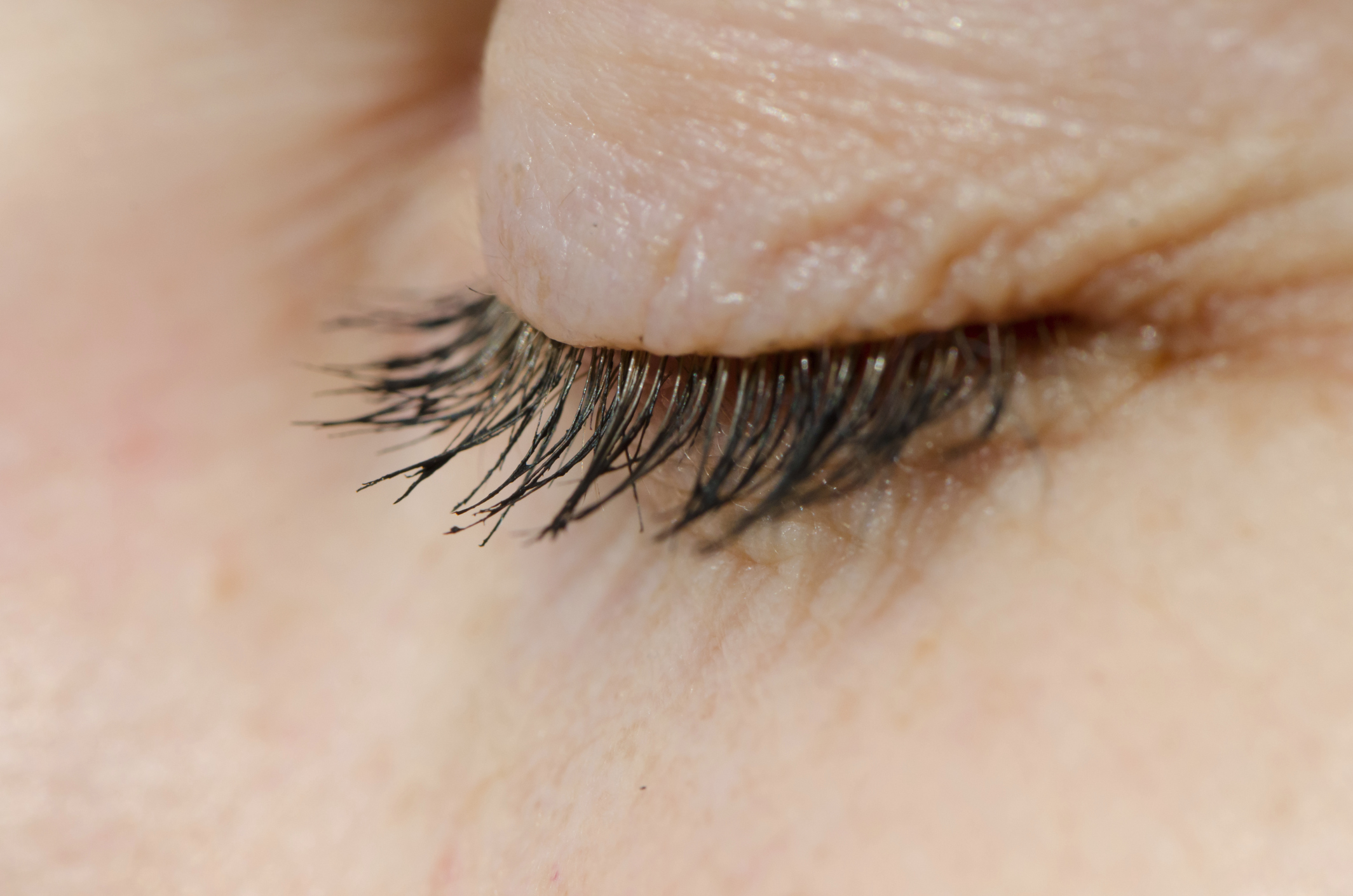 fine lines on eyelids